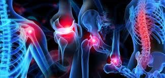 Orthopaedics